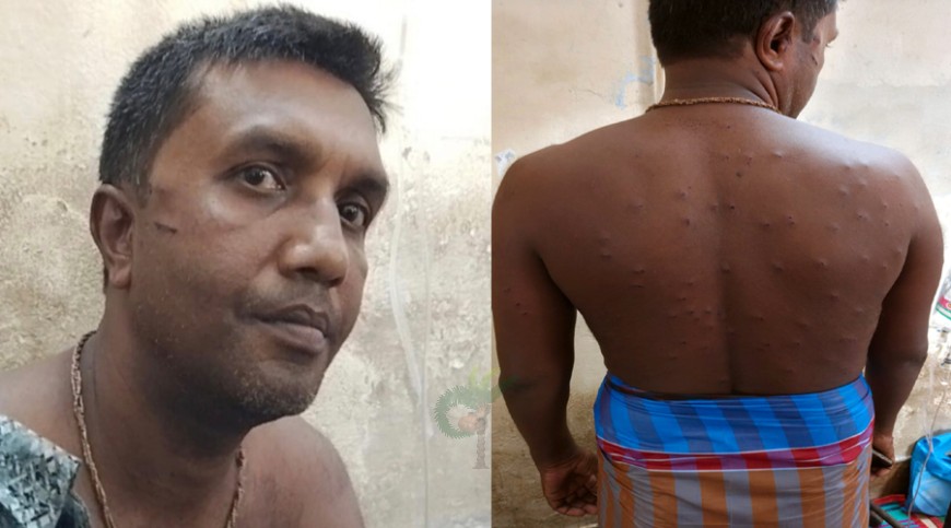 বিএসেএফের গুলিতে আহত ব্যক্তি যশোর হাসপাতালে